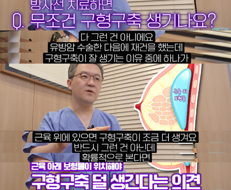 유방재건수술 후 구형구축, 유독 잘 생기는 이유가 있다? 사진 3